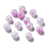 Two Tone Opaque Acrylic Beads SACR-P024-01A-W04-1